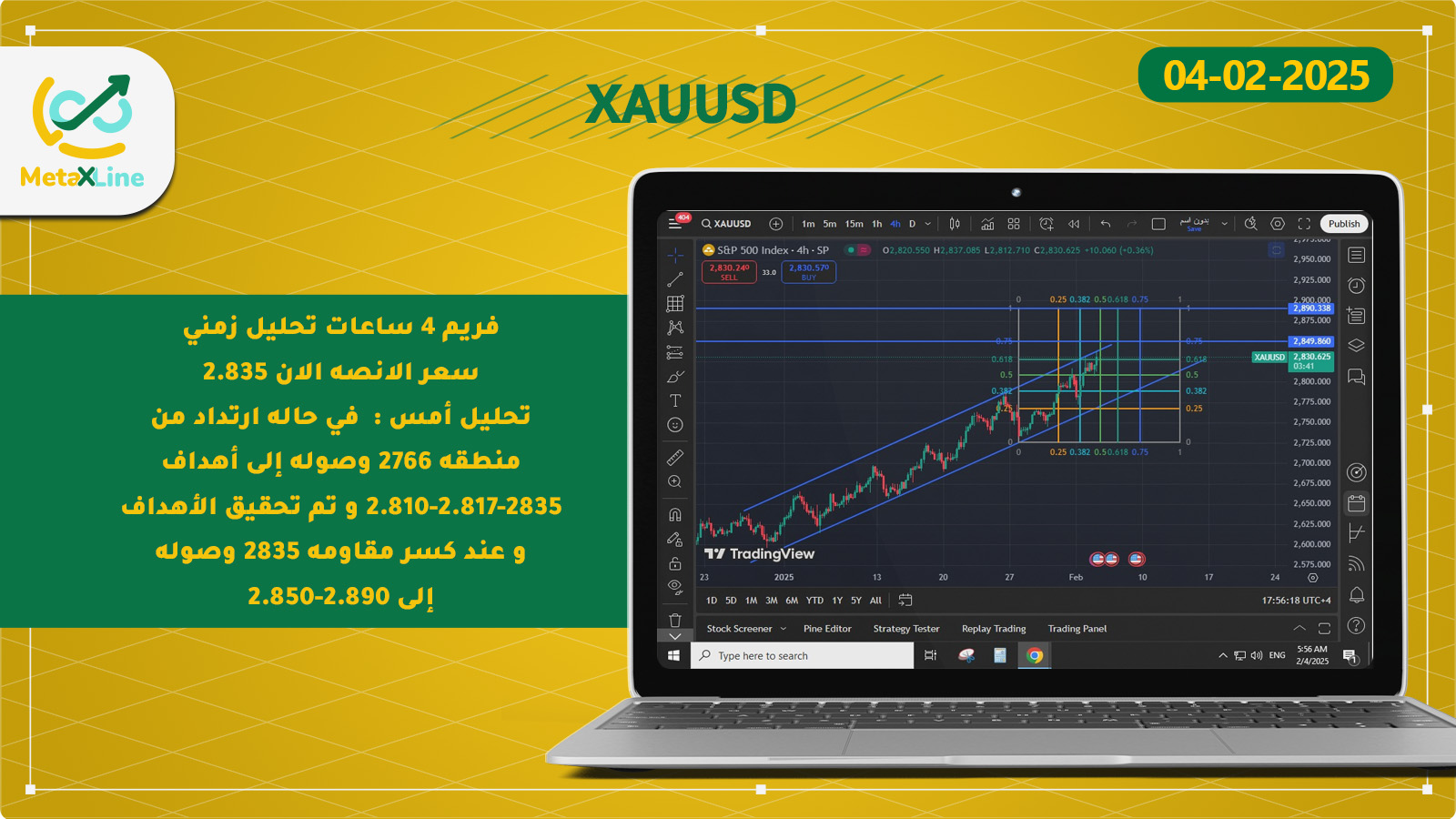 XAUUSD 